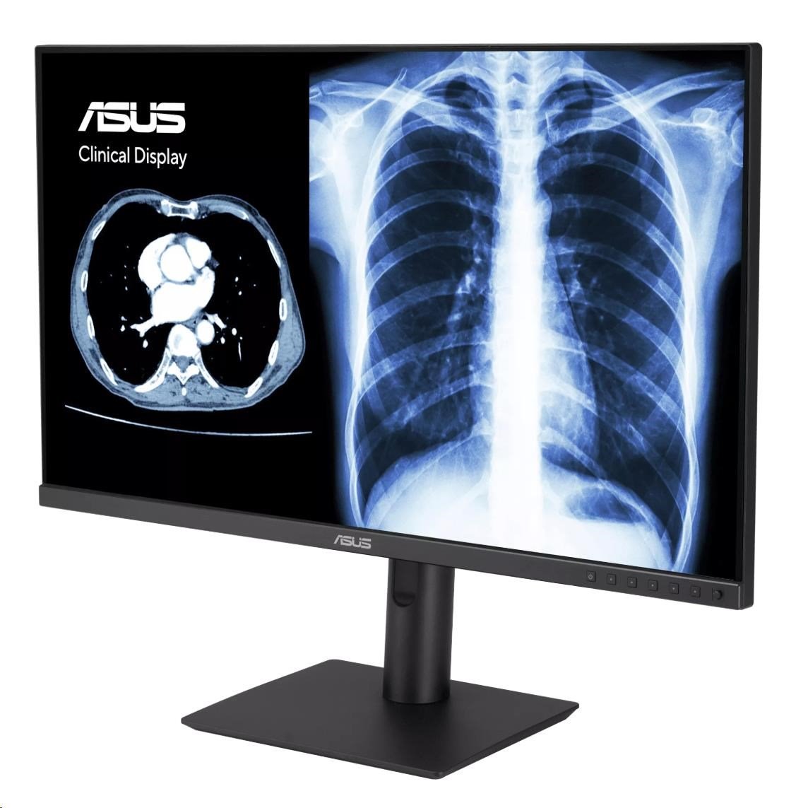 ASUS Monitor Healthcare MH2441A, 23,8", IPS, 1920x1080, 16:9, 5ms, DP, HDMI, USB-C, 60Hz, Repro