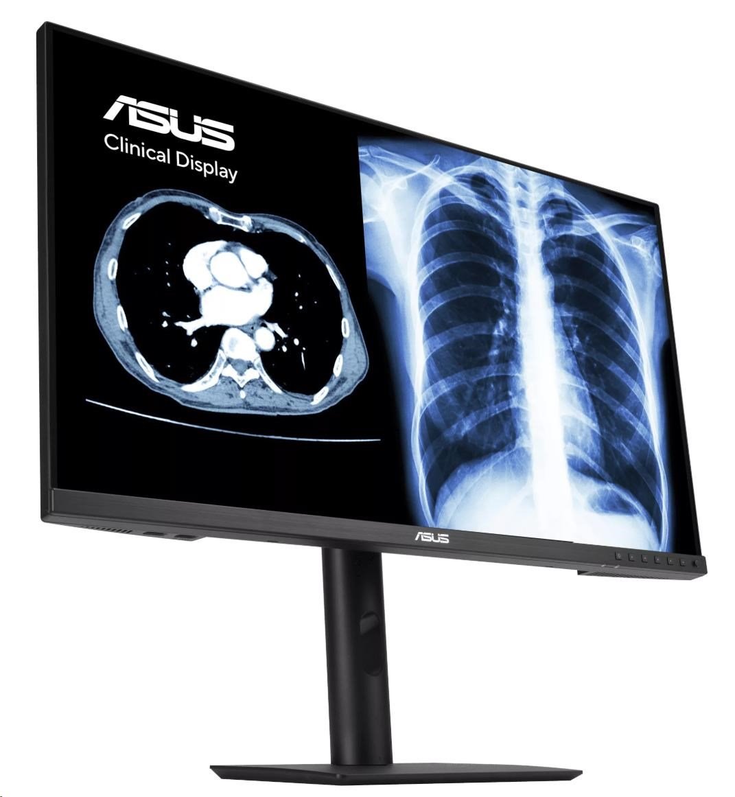 ASUS Monitor Healthcare MH2441A, 23,8", IPS, 1920x1080, 16:9, 5ms, DP, HDMI, USB-C, 60Hz, Repro