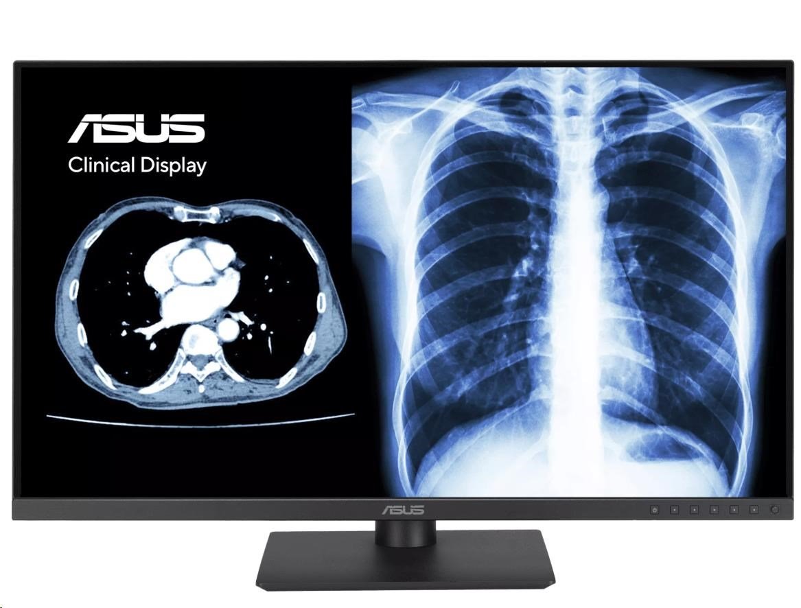ASUS Monitor Healthcare MH2441A, 23,8", IPS, 1920x1080, 16:9, 5ms, DP, HDMI, USB-C, 60Hz, Repro