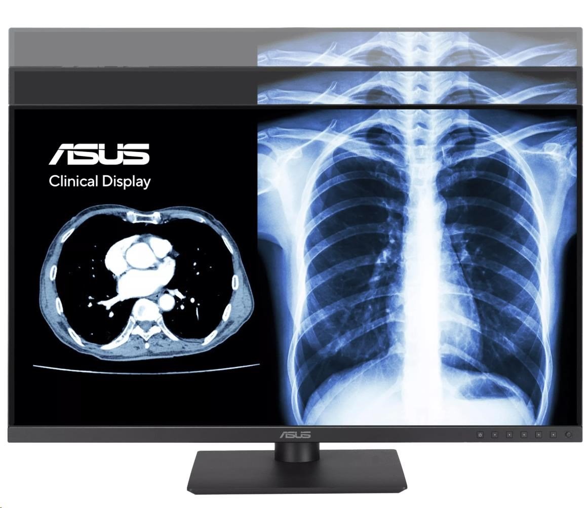 ASUS Monitor Healthcare MH2441A, 23,8", IPS, 1920x1080, 16:9, 5ms, DP, HDMI, USB-C, 60Hz, Repro